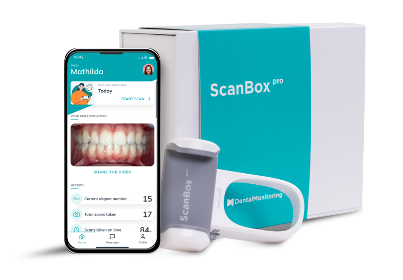 scanbox